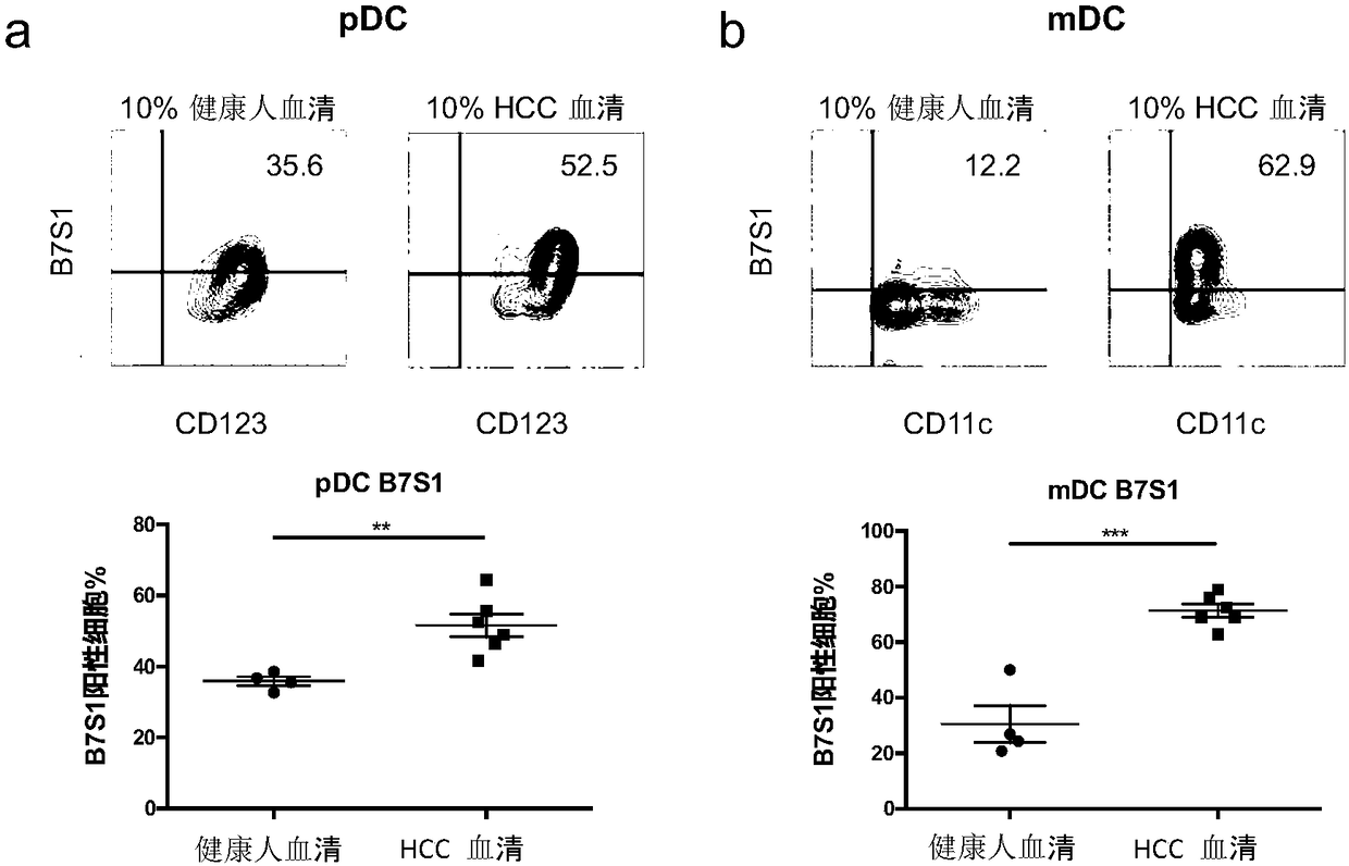 Application of B7S1 (B7 family member 1) inhibitor in preparing liver cancer medicine