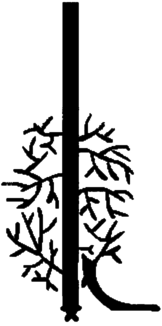 Flap model for shunt and decompression of blood vessel