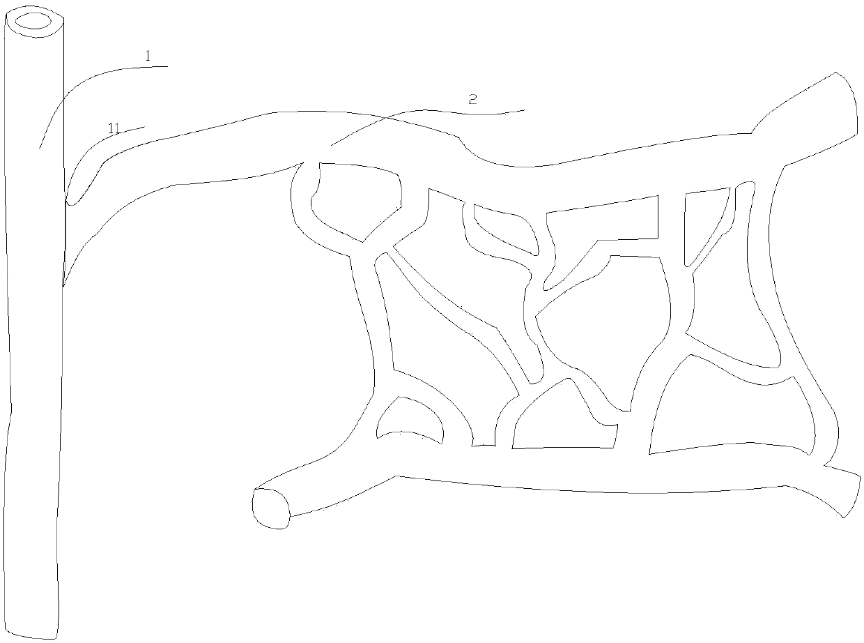 Flap model for shunt and decompression of blood vessel