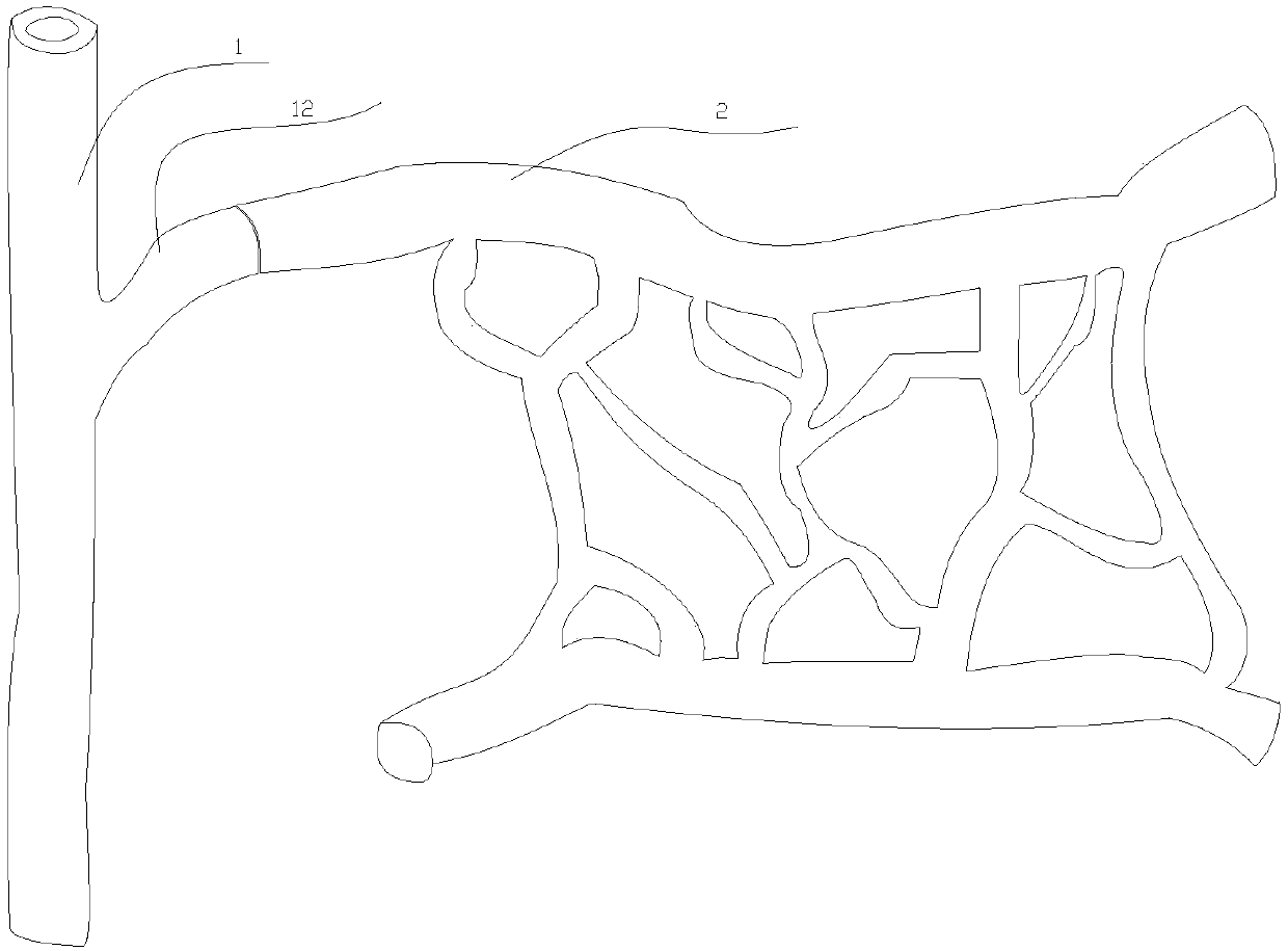 Flap model for shunt and decompression of blood vessel