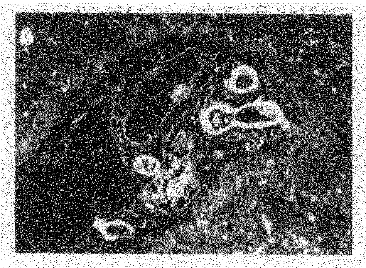 Composition For Diagnosing Amyloid-Related Diseases