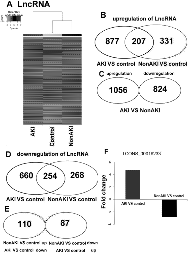 Molecular marker TCONS_00016233, kit and application