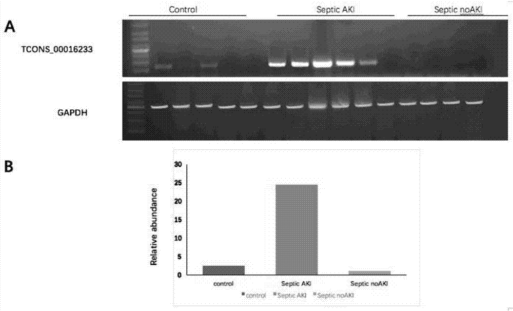 Molecular marker TCONS_00016233, kit and application