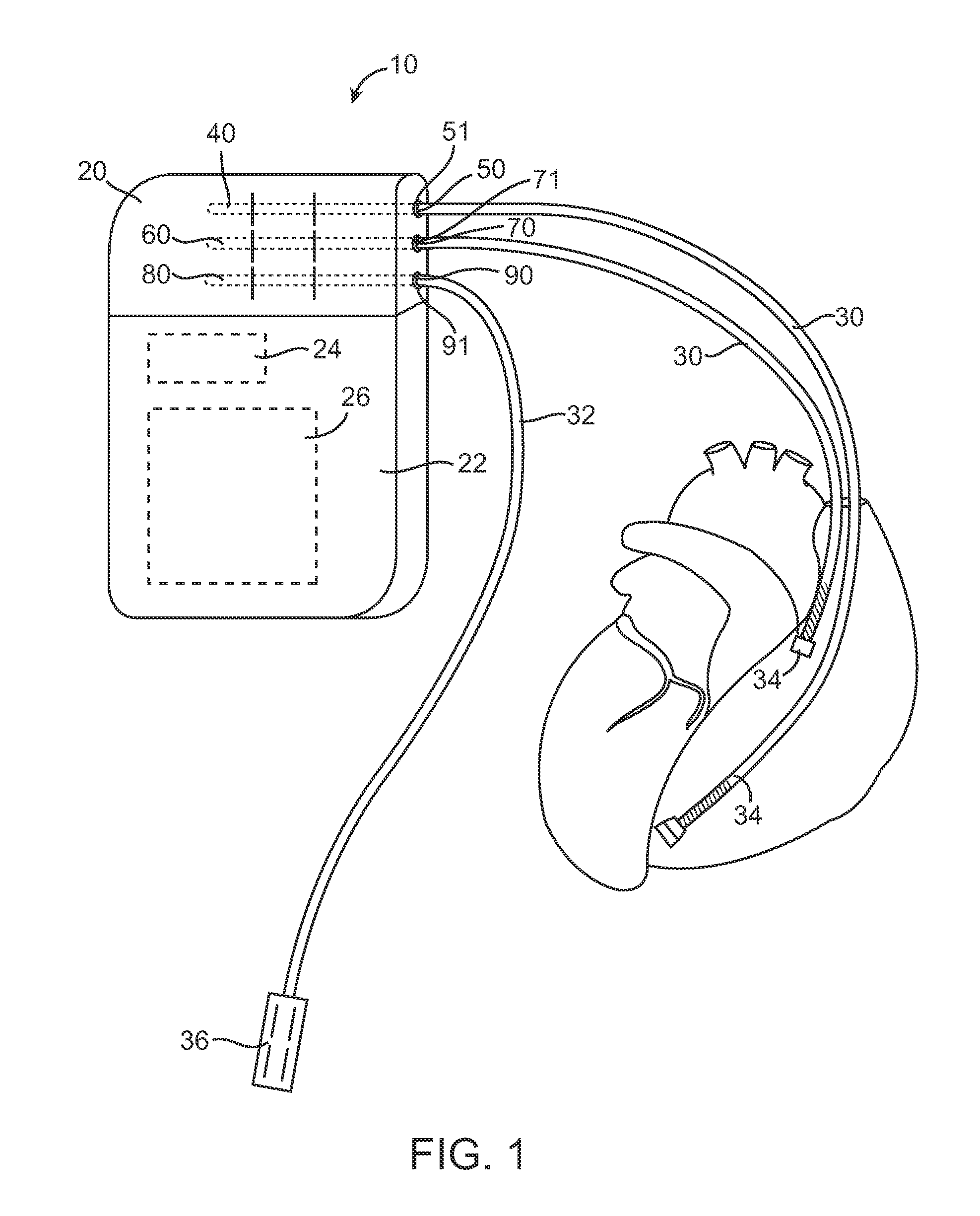 Lockout connector arrangement for implantable medical device