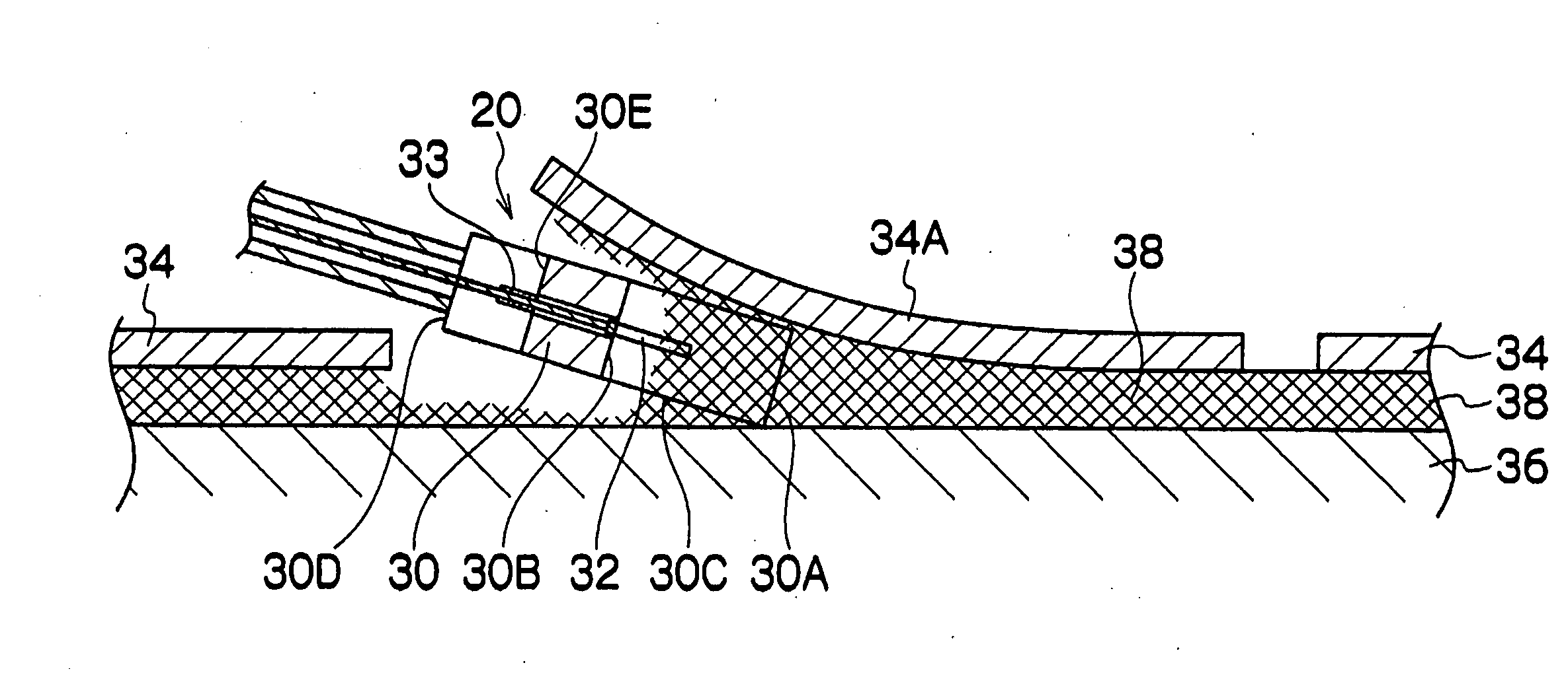 Instrument for Endoscopic Treatment