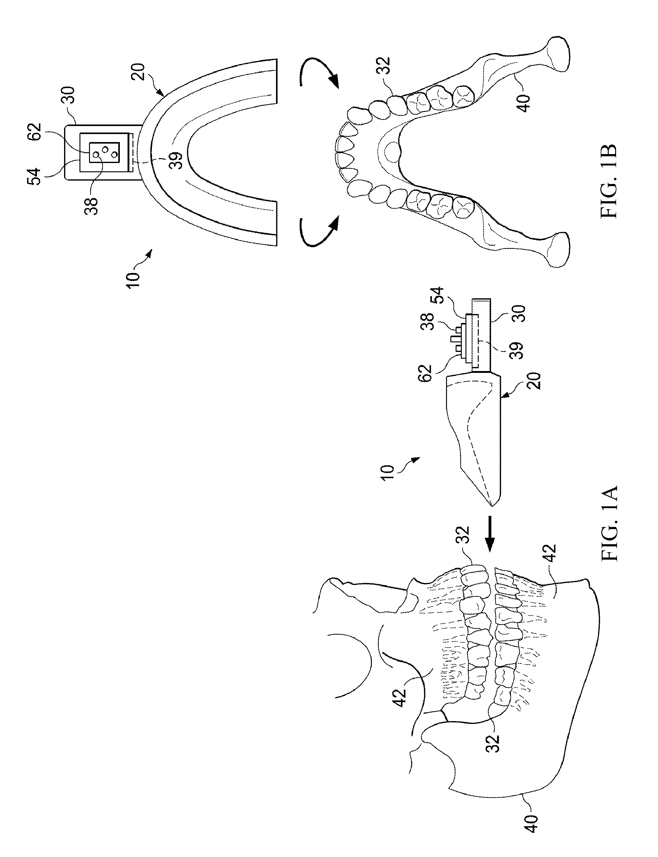 Vibrating orthodontic remodelling device