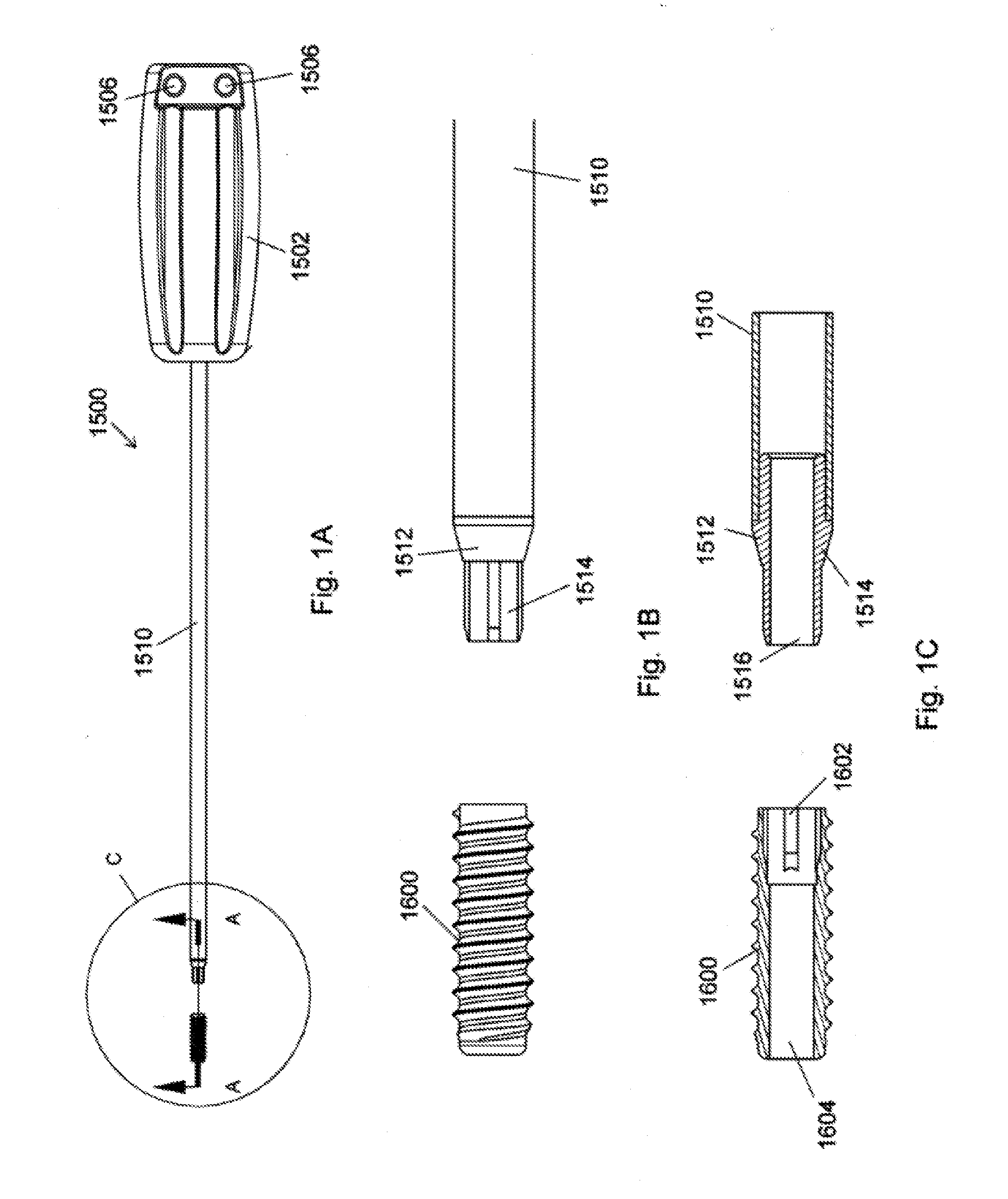 Implant placement systems and one-handed methods for tissue fixation using same