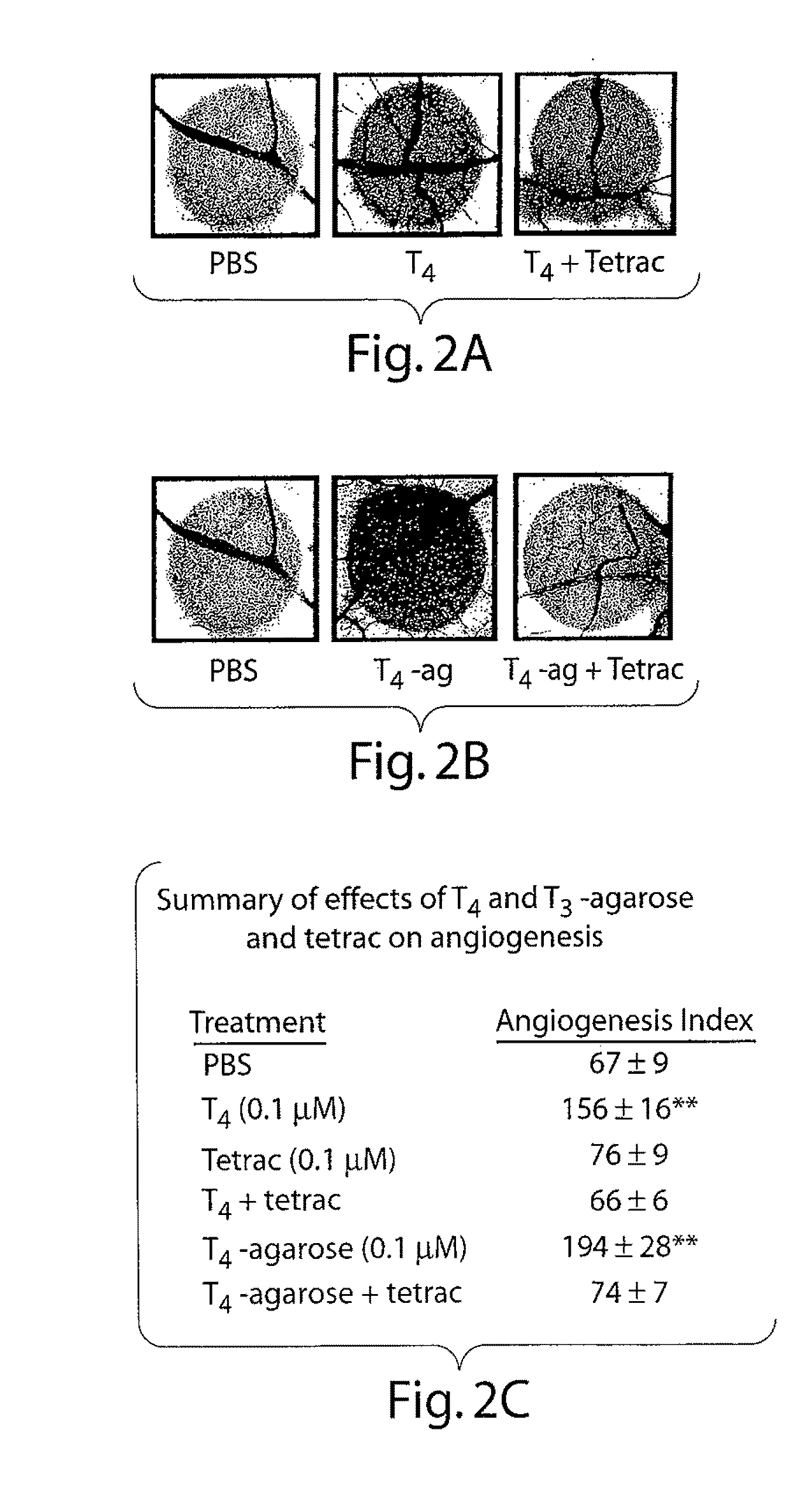 Thyroid Hormone Analogs and Methods of Use