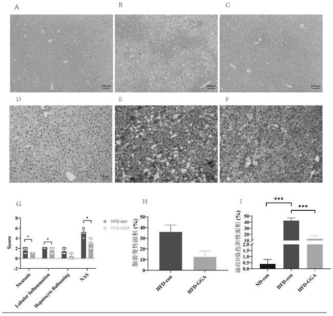 Application of teprenone in preparation of medicine for preventing and treating fatty liver/steatohepatitis