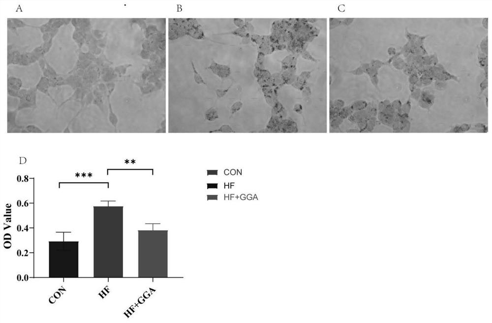 Application of teprenone in preparation of medicine for preventing and treating fatty liver/steatohepatitis