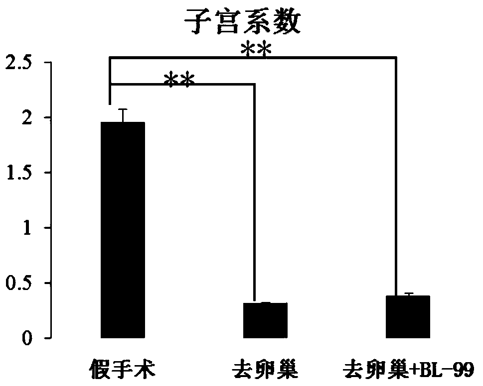 Bifidobacterium lactis capable of preventing osteoporosis and application of bifidobacterium lactis capable of preventing osteoporosis