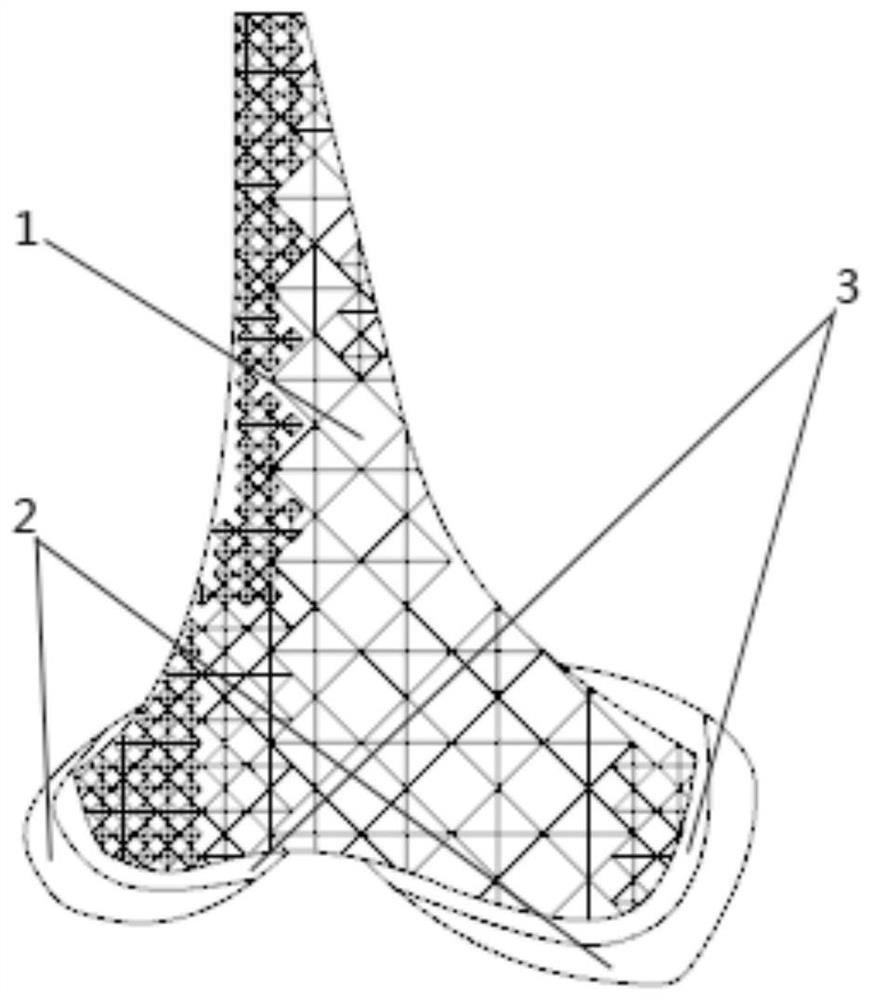 Multi-material porous distal femur implant and manufacturing method thereof