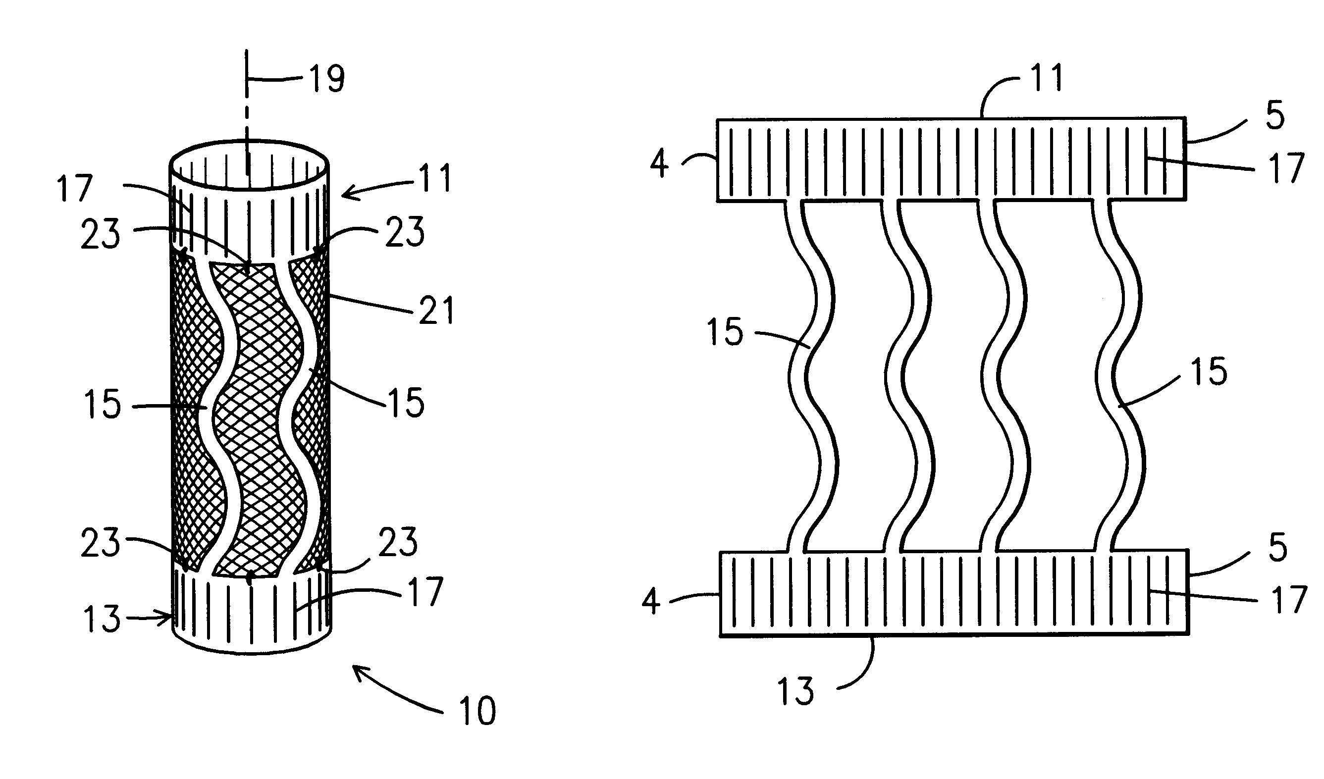 Low profile highly expandable stent