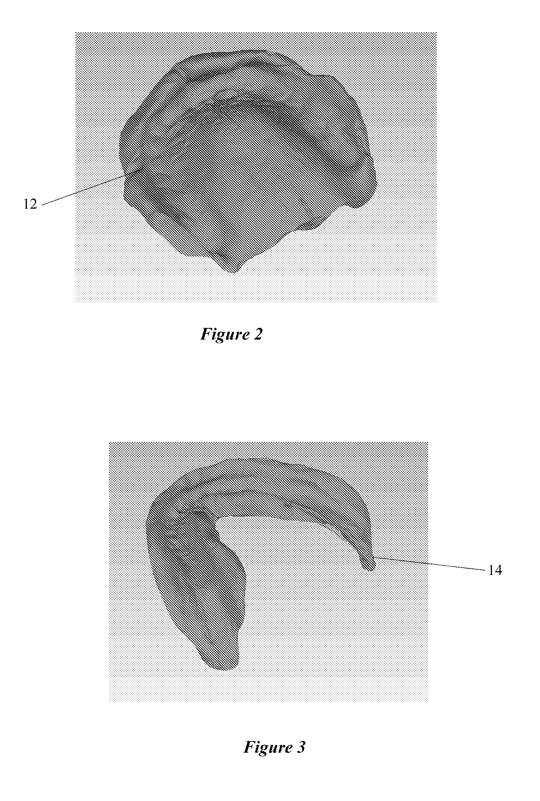 Systems and process for forming anatomical features in dentures