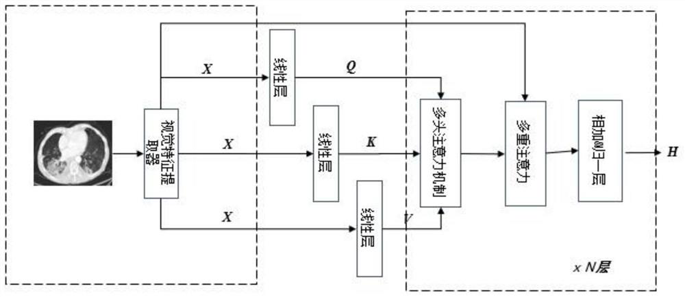 CT report generation method based on Transformer