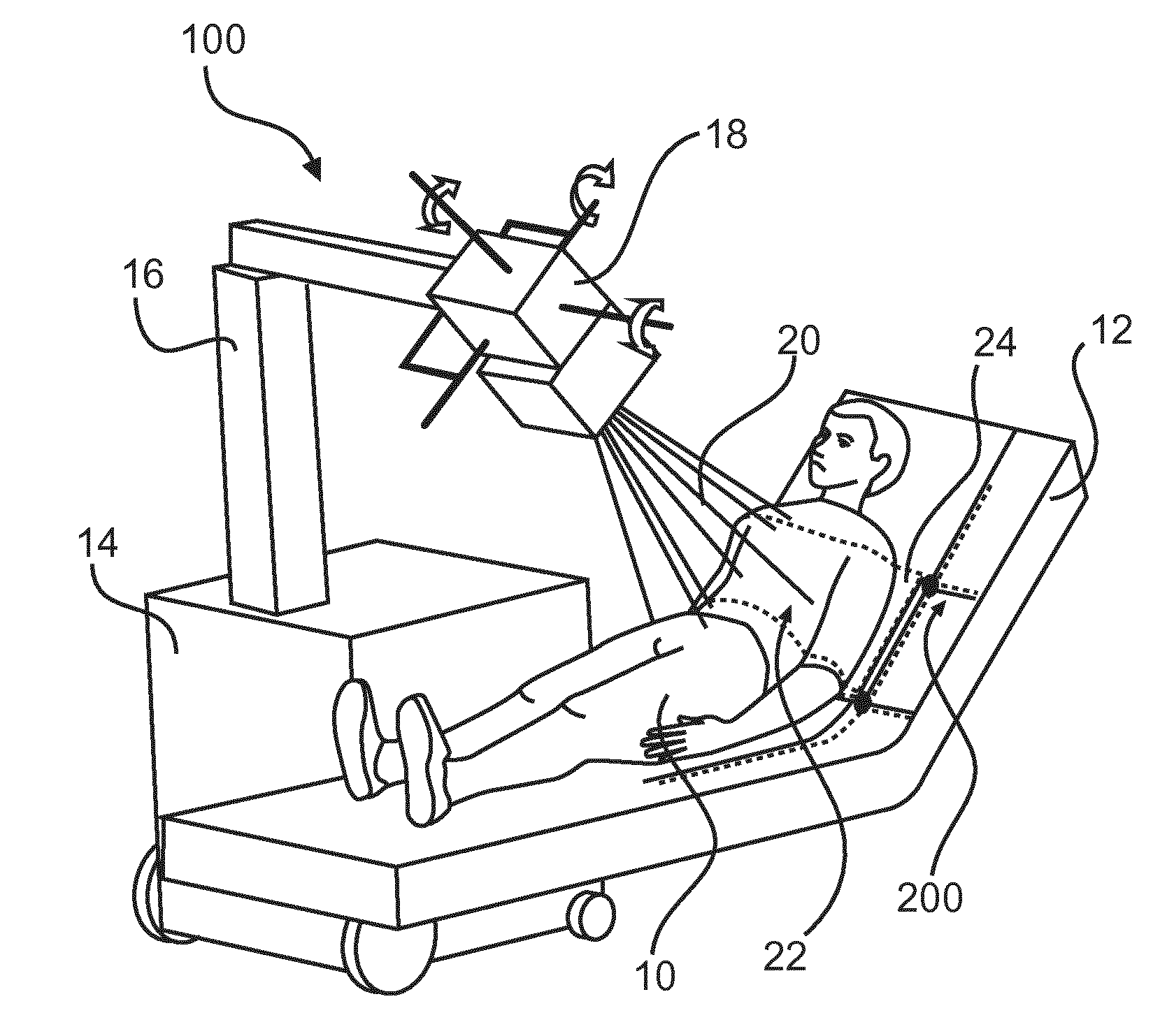 Tube-detector alignment using light projections