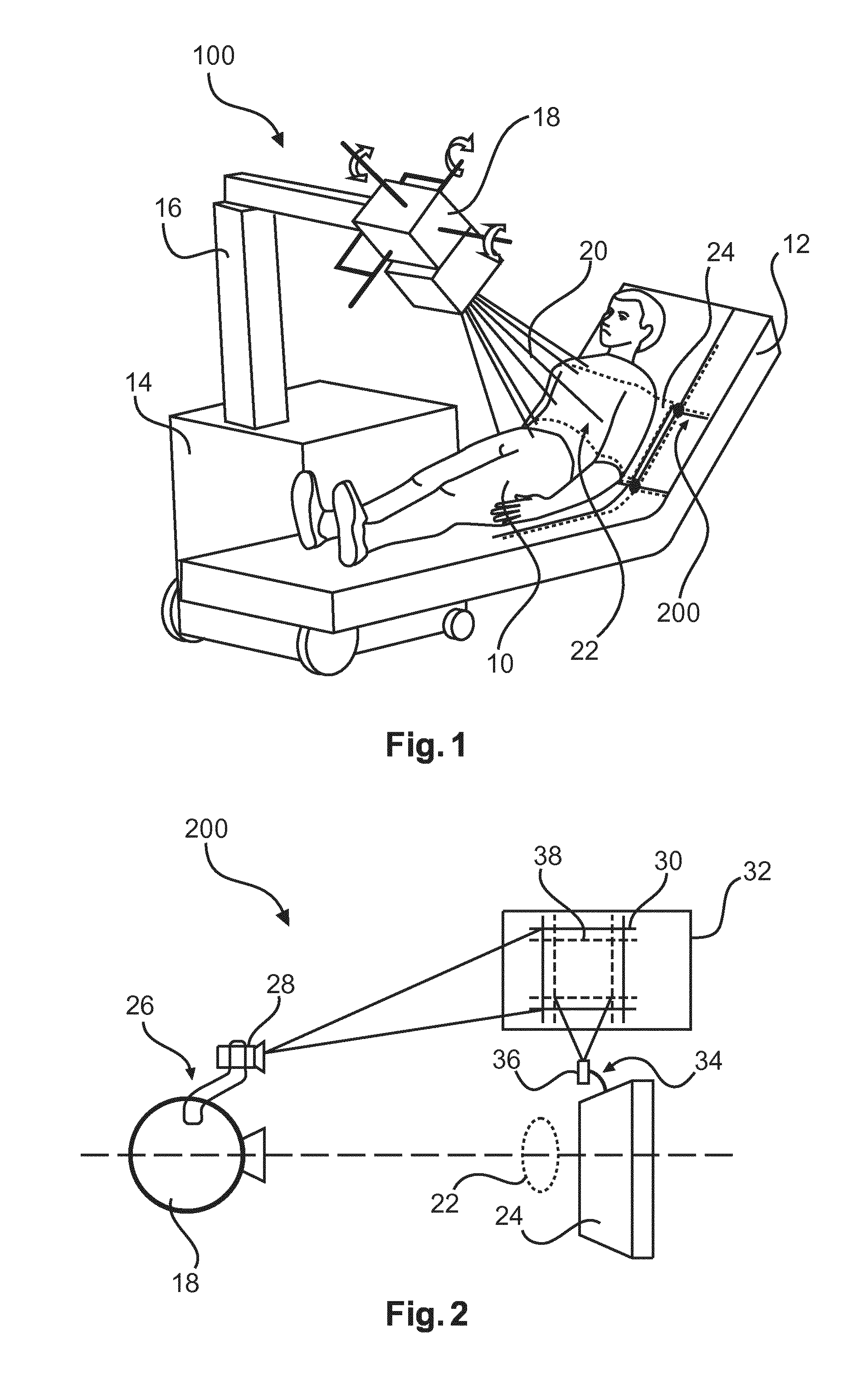 Tube-detector alignment using light projections