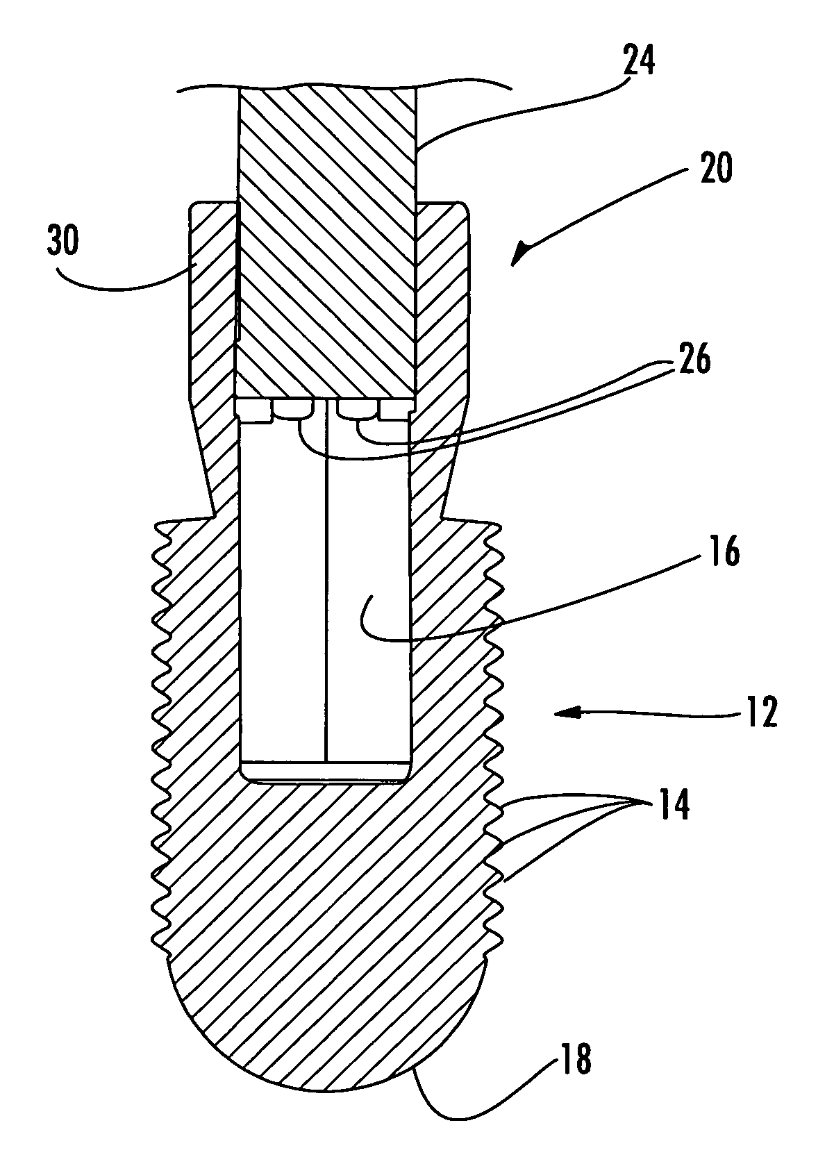 Torque limiting break-away head fastener and related methods