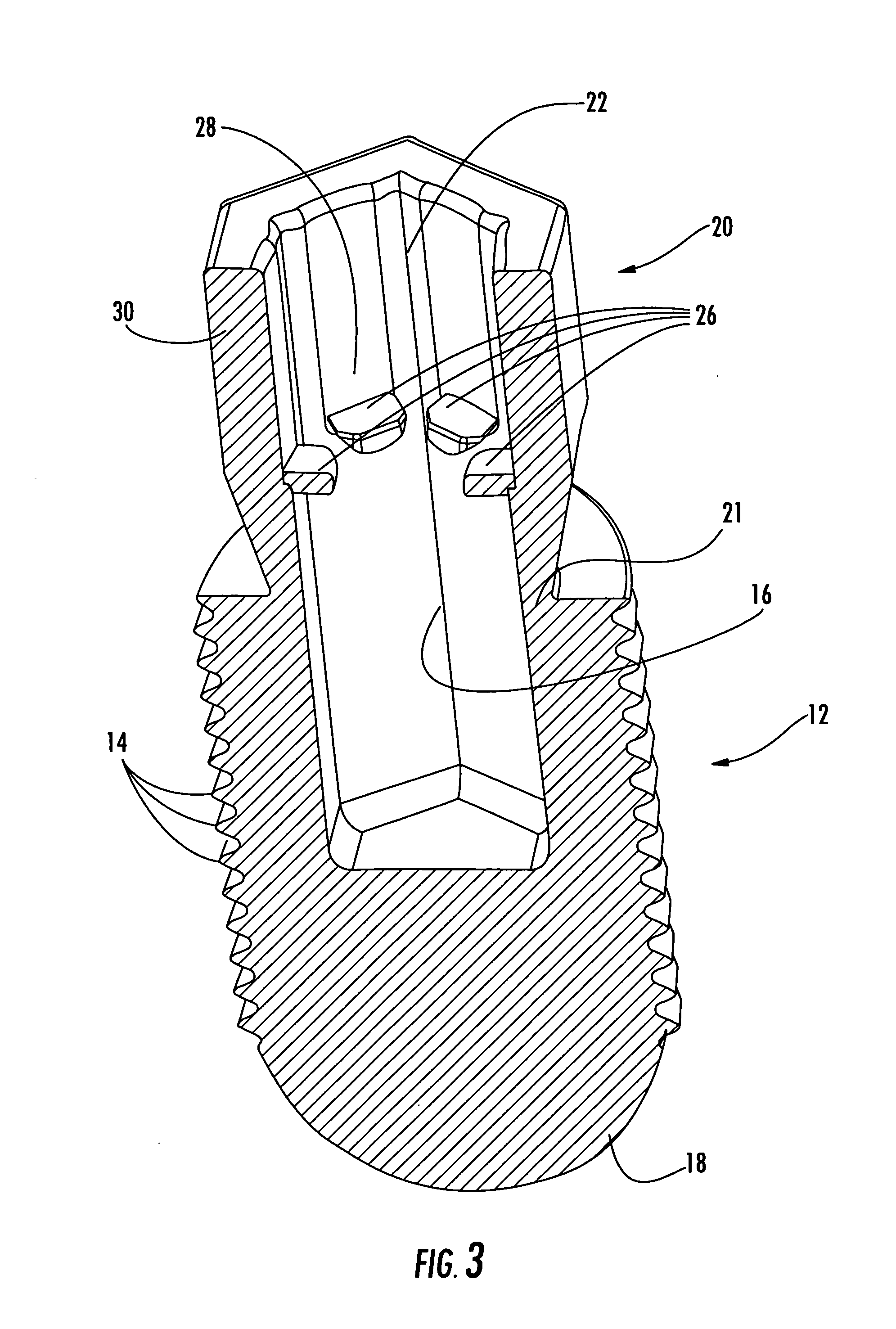 Torque limiting break-away head fastener and related methods