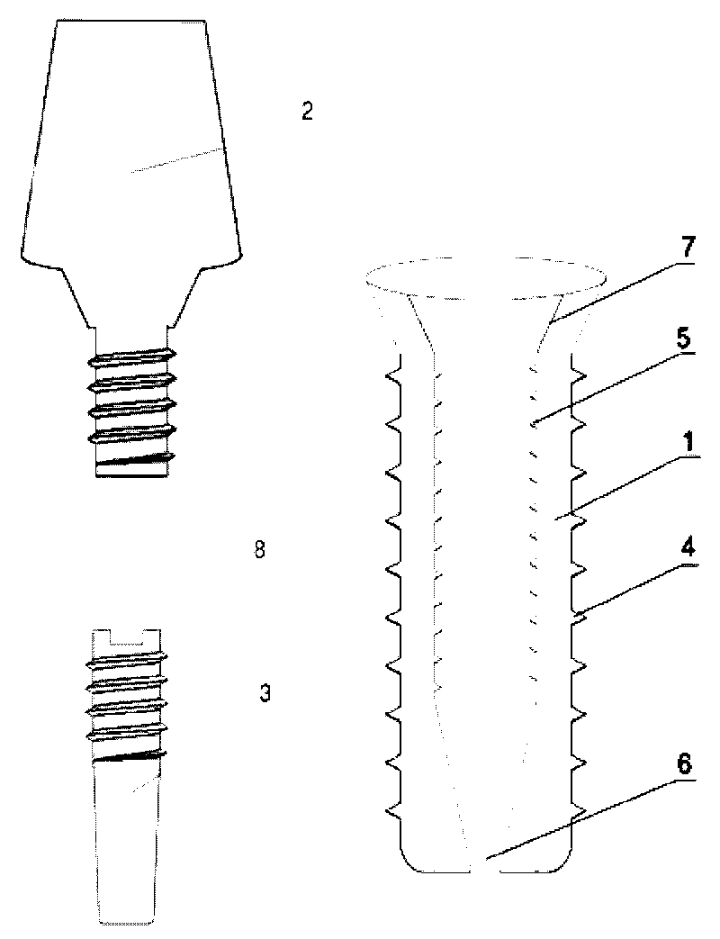 Expanded tooth implant