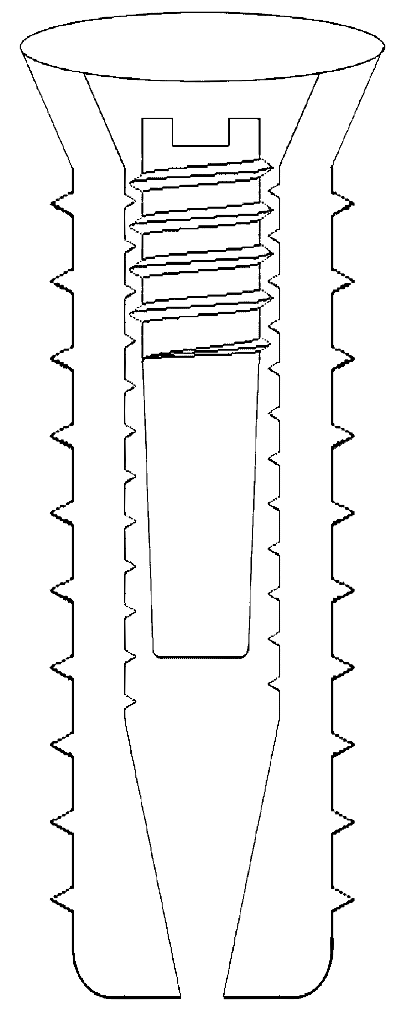 Expanded tooth implant