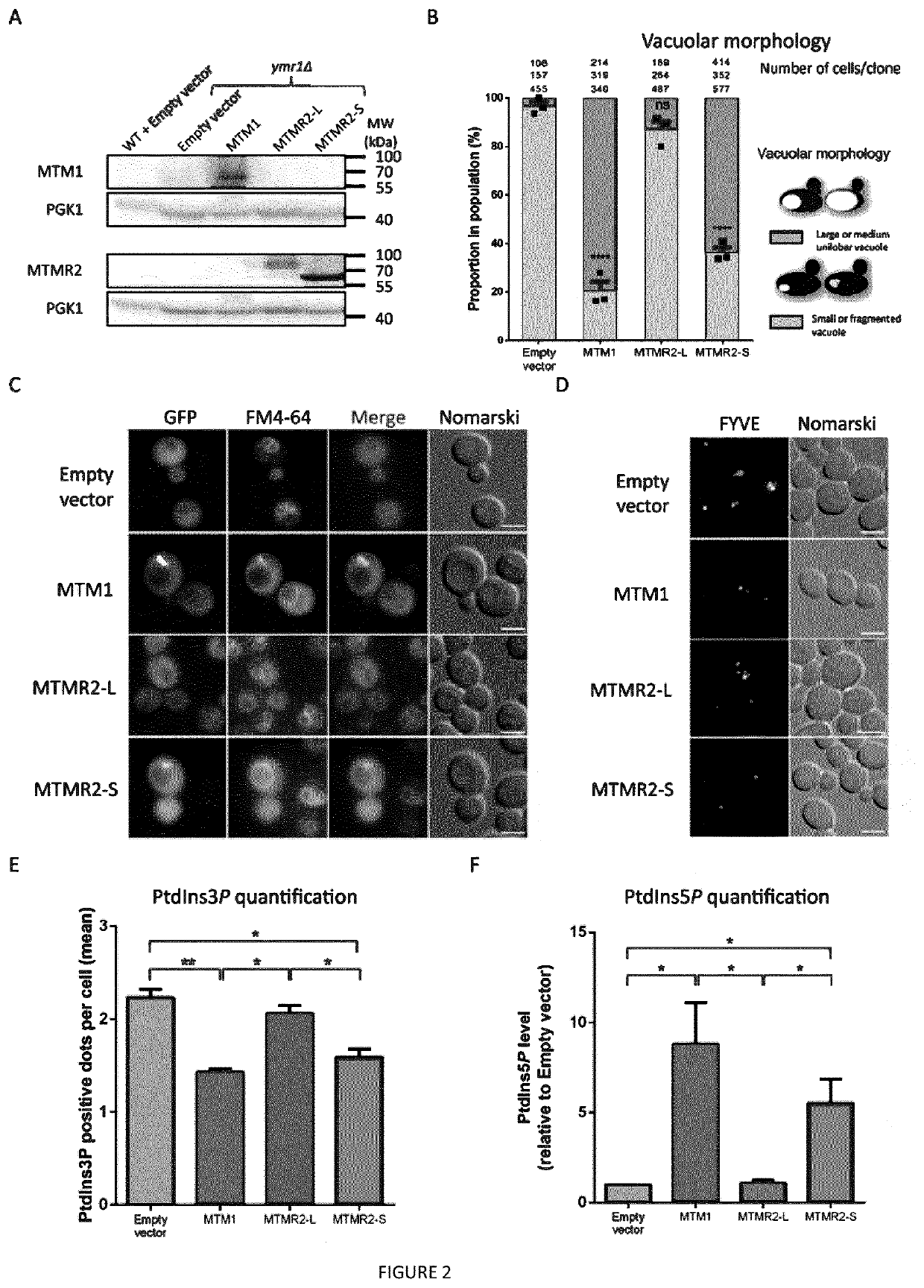 Mtmr2-s polypeptide for use in the treatment of myopathies