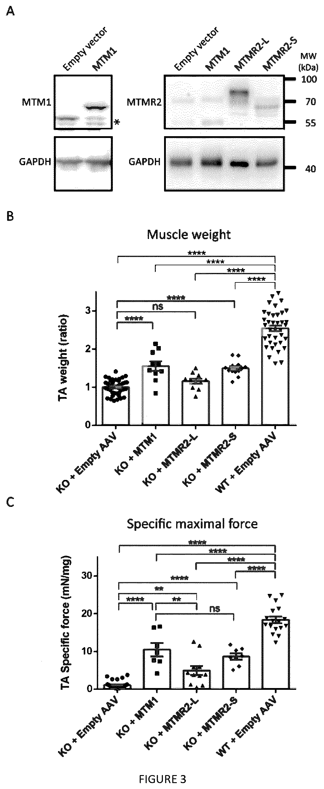 Mtmr2-s polypeptide for use in the treatment of myopathies