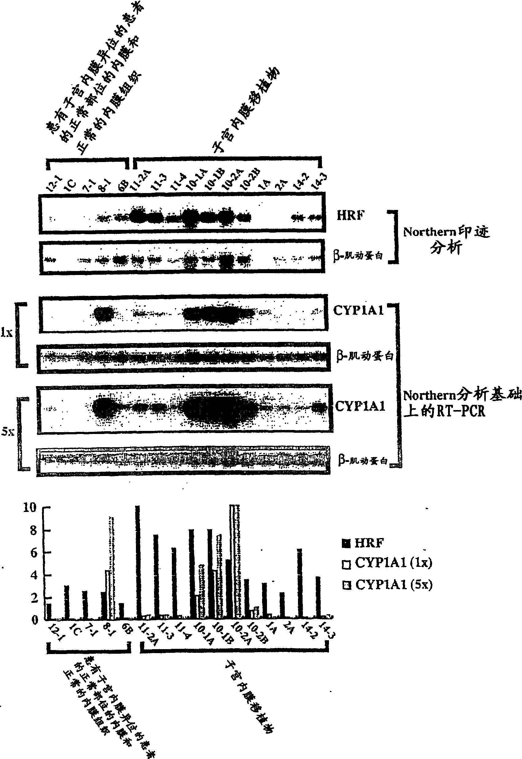 Method for diagnosing endometriosis-related disease in womb