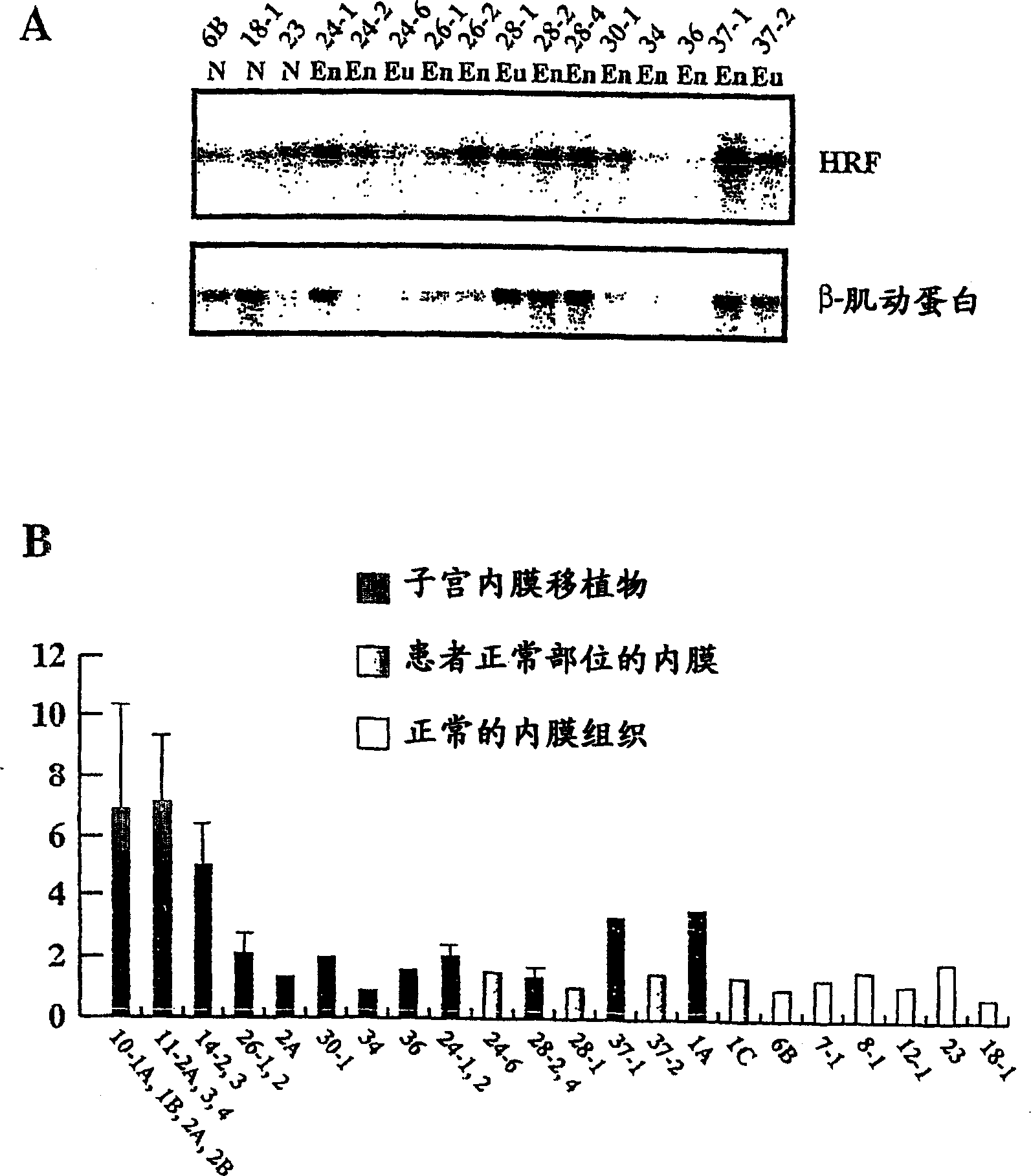 Method for diagnosing endometriosis-related disease in womb