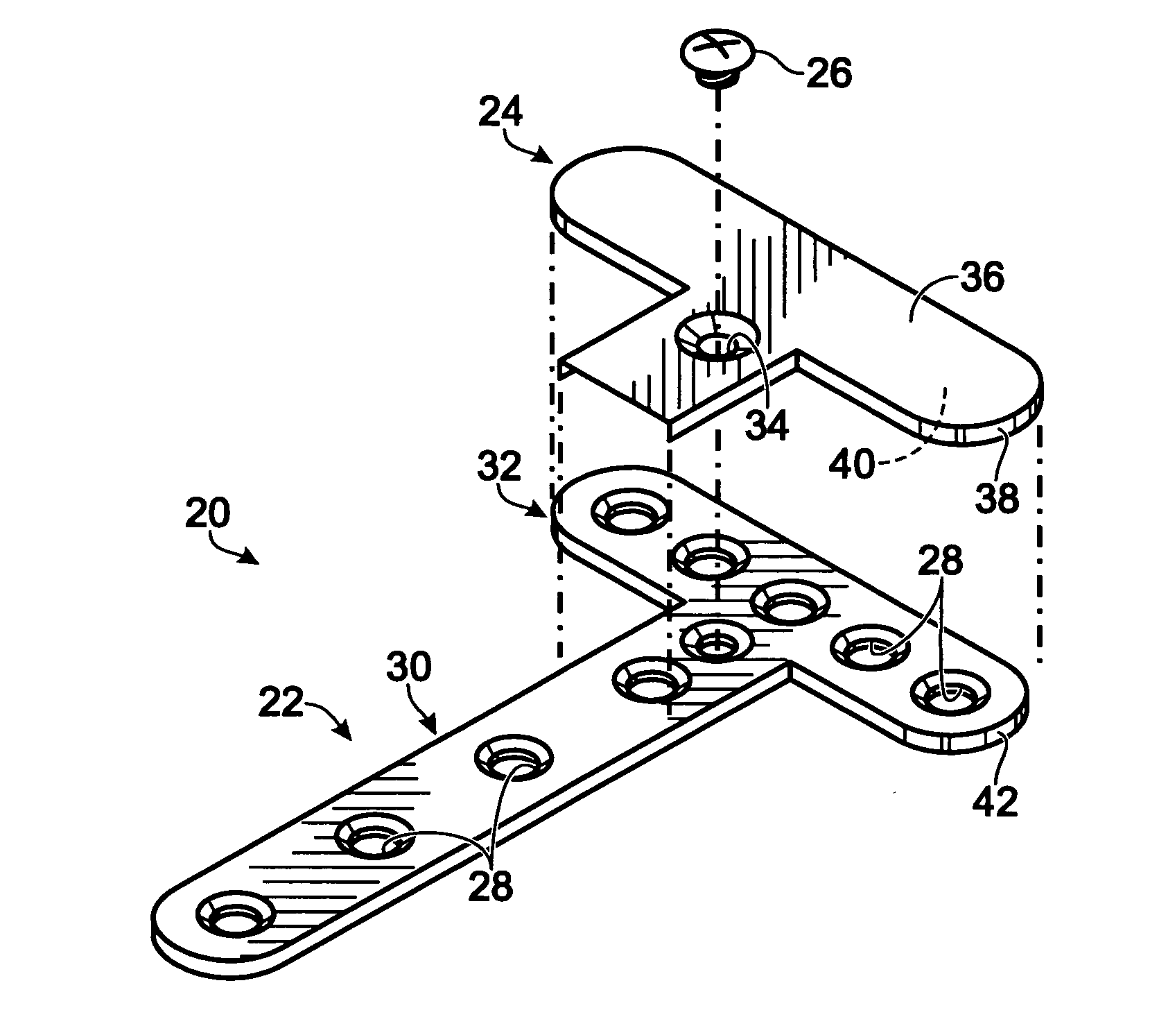 Bone plate with cover