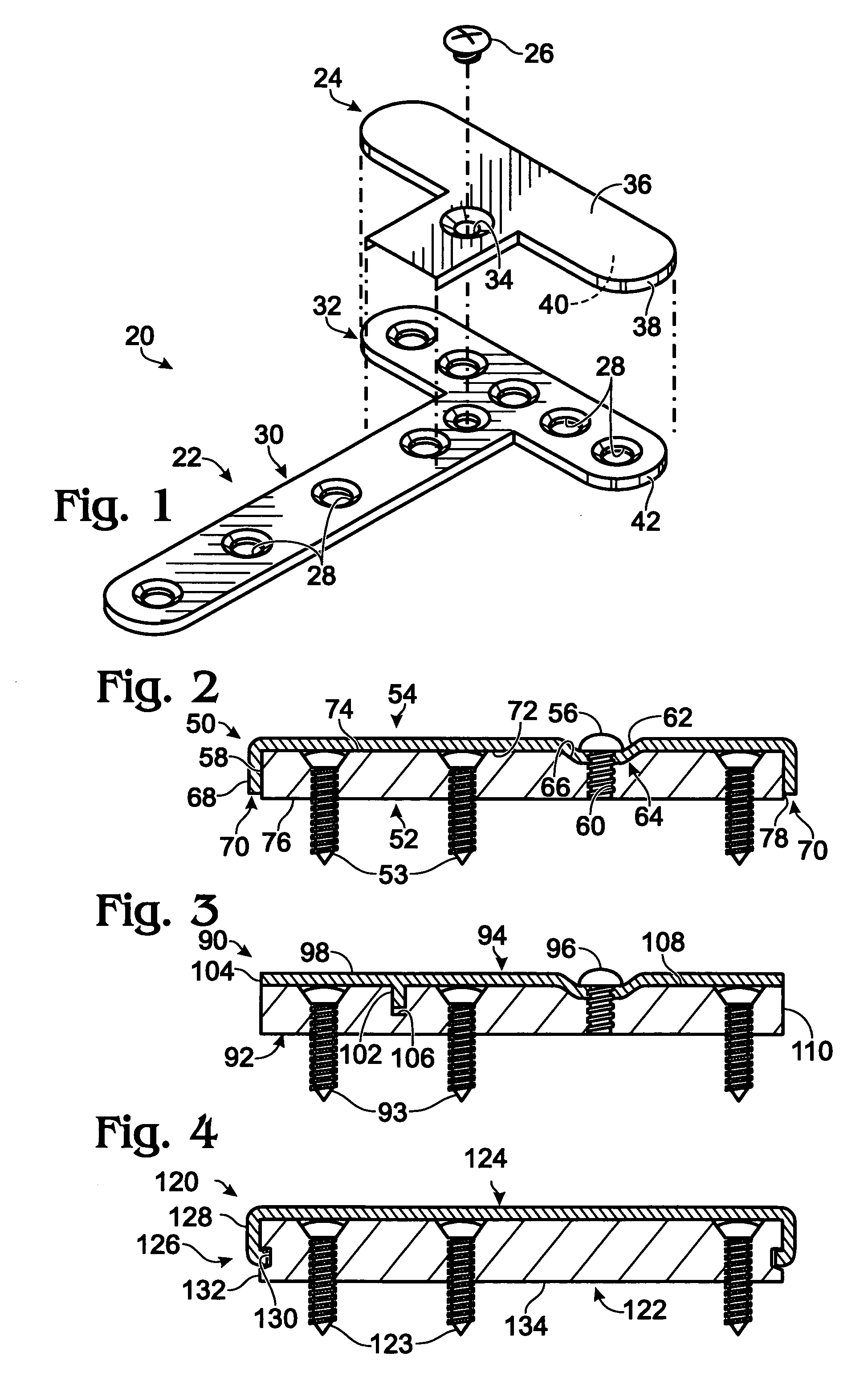 Bone plate with cover