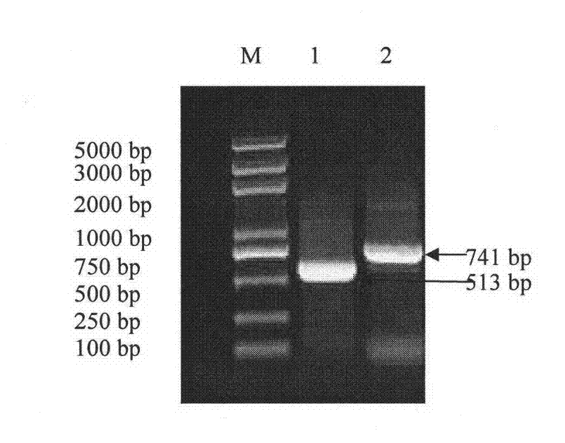 Fusion protein for resisting chicken coccidiosis, preparation and application thereof