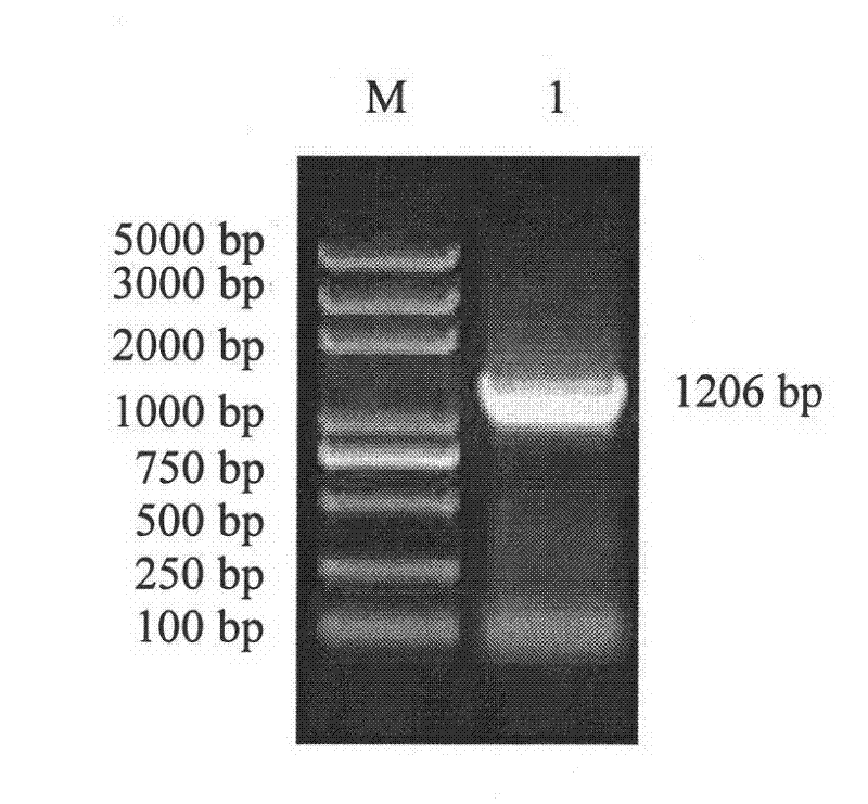 Fusion protein for resisting chicken coccidiosis, preparation and application thereof