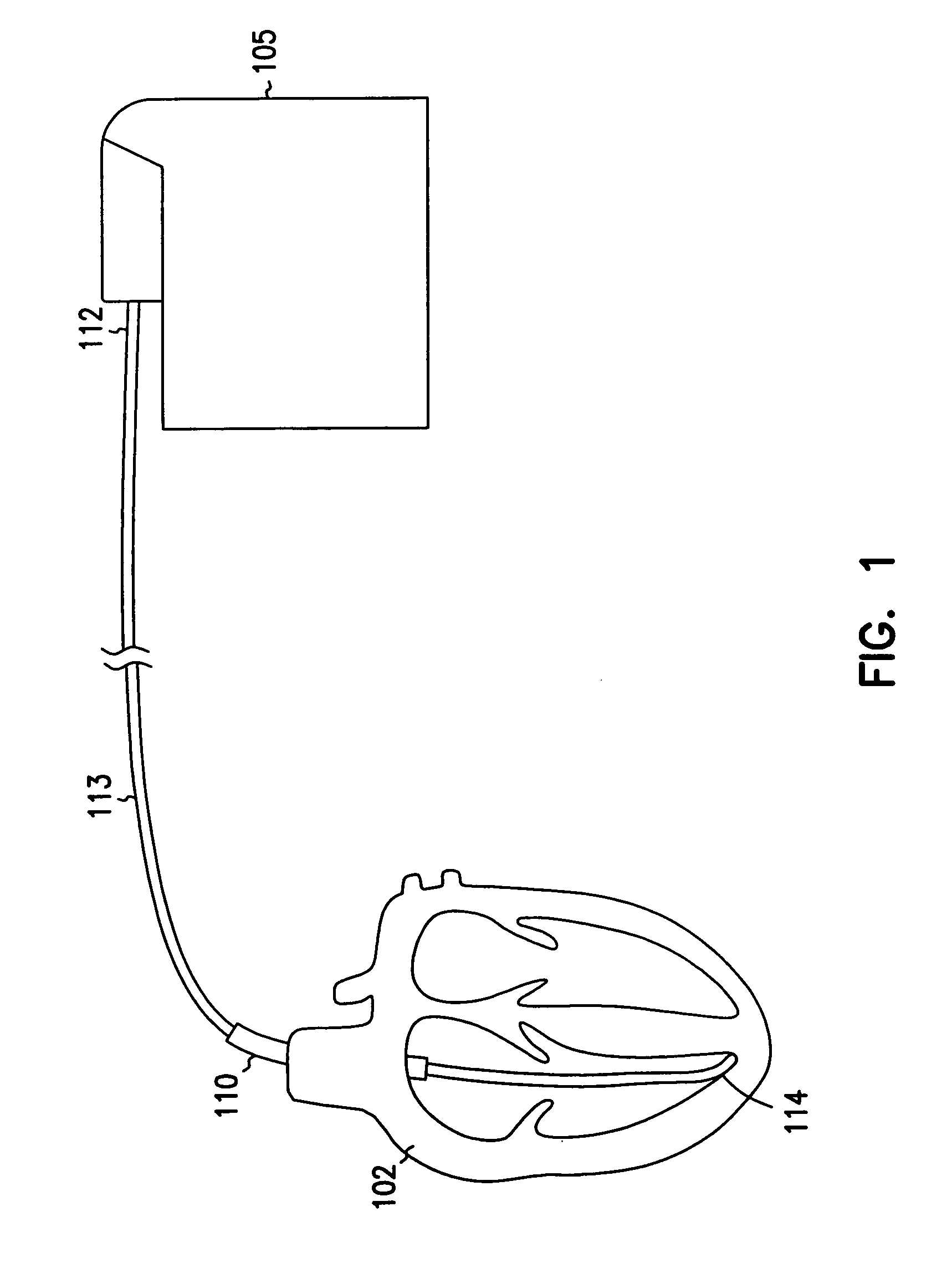 Method for making a terminal connector