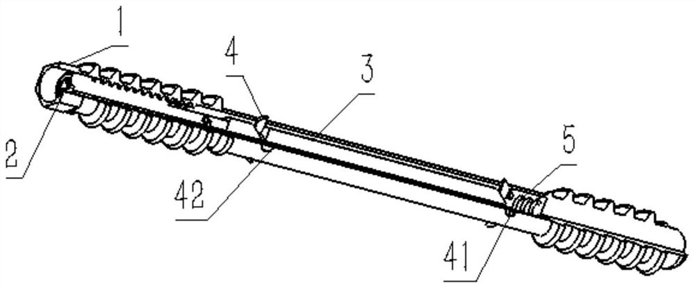 Anti-rotation orthopedic internal fixator