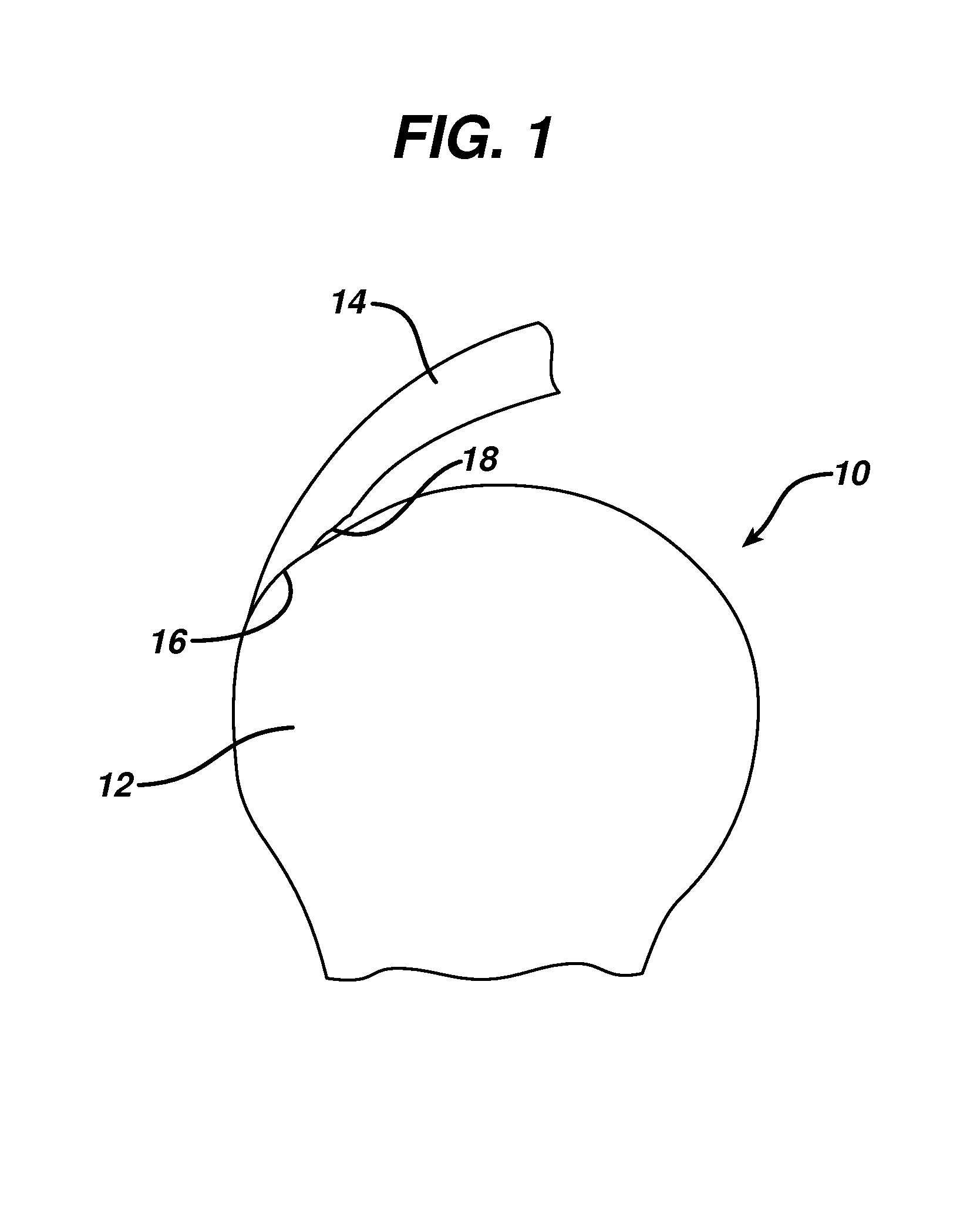 Partial thickness rotator cuff repair system and method