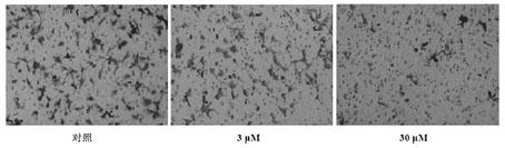 Application of formononetin in preparing of medicament for restricting angiogenesis