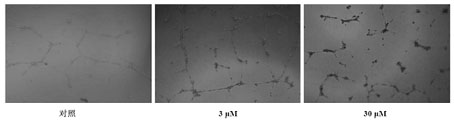 Application of formononetin in preparing of medicament for restricting angiogenesis