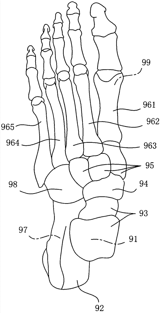 Arch correction pad capable of finely adjusting correction area and correction method of arch correction pad