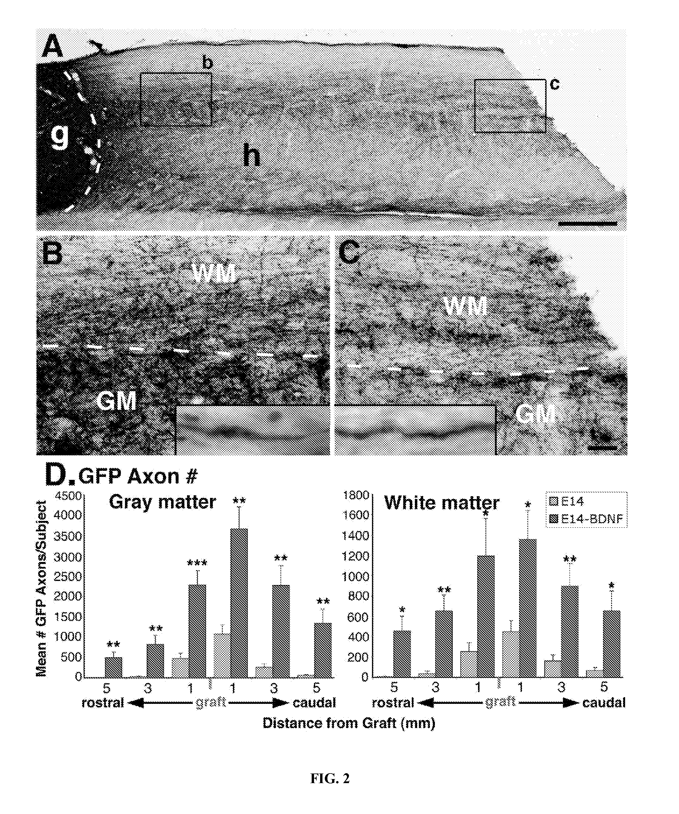 Methods for Use of Neural Stem Cell Compositions for Treatment of Central Nervous System Lesions