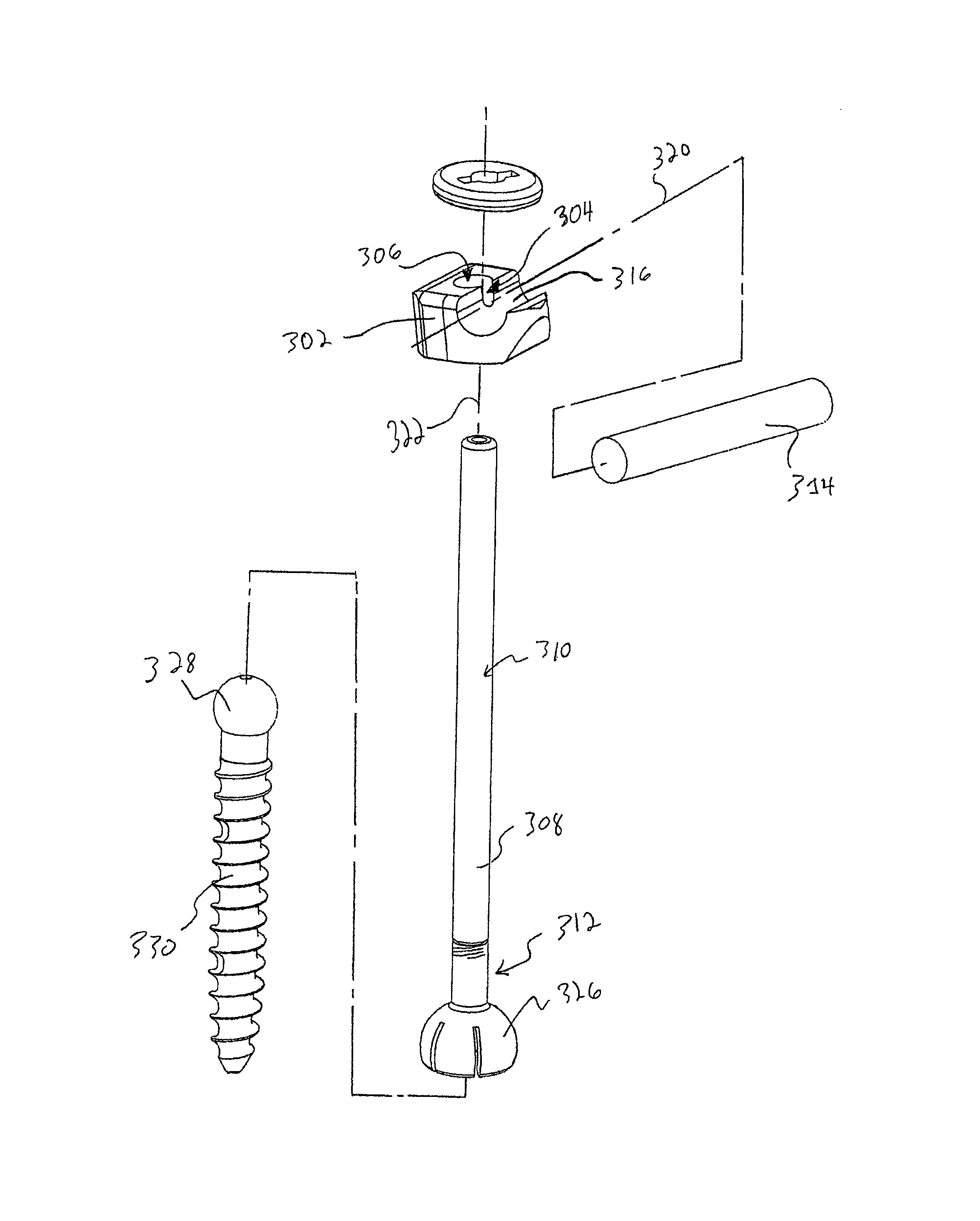 Spinal fixation system and method