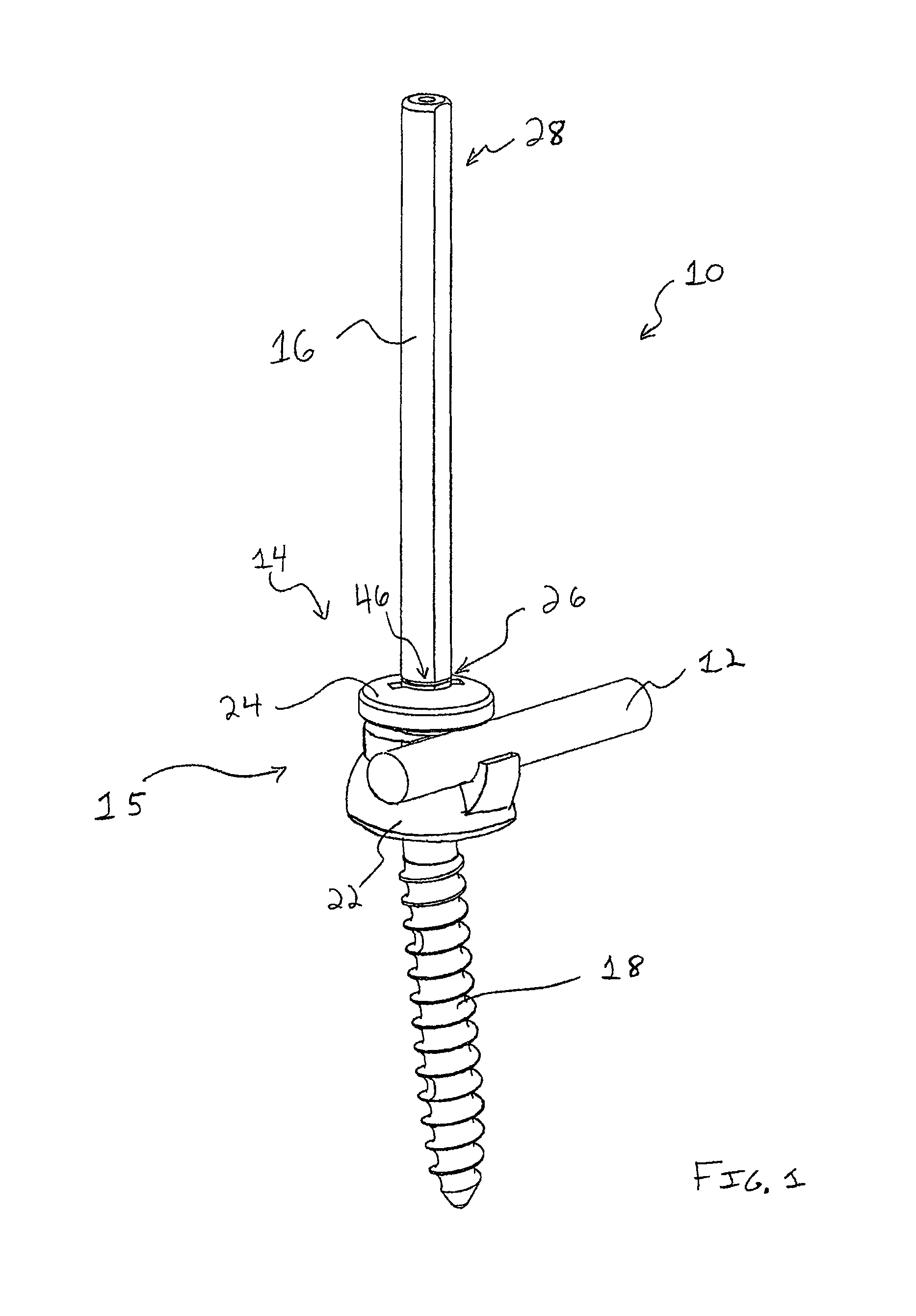 Spinal fixation system and method