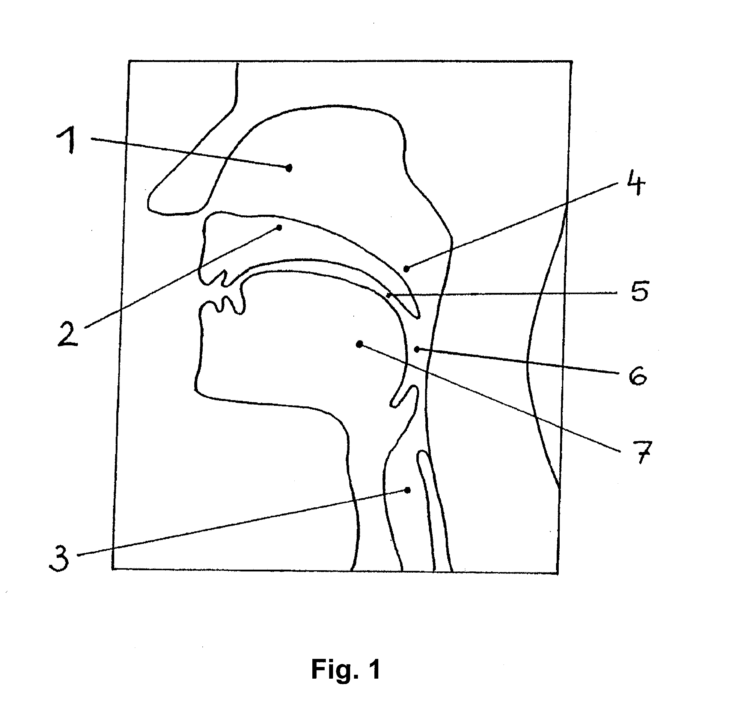 Device for splinting a cavity, organ duct and/or vessel