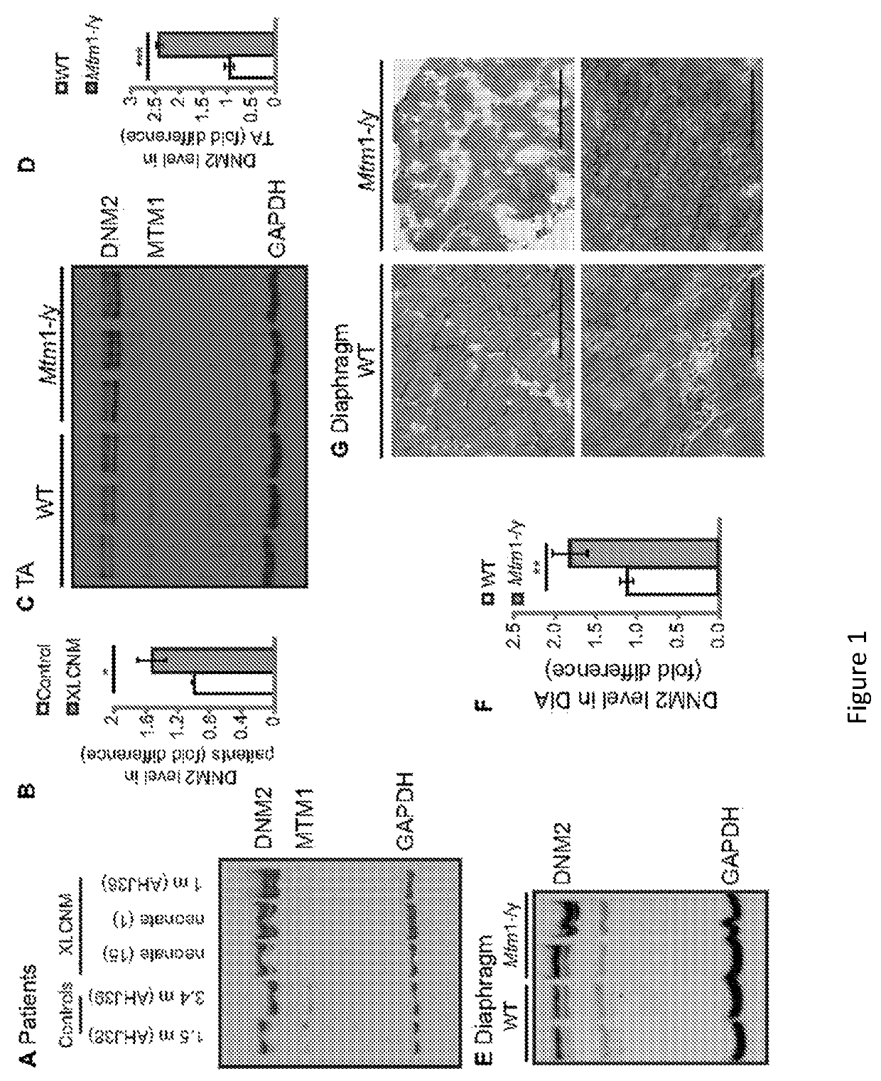 Dynamin 2 inhibitor for the treatment of centronuclear myopathies