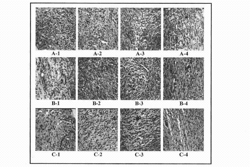 Particle blood platelet dry powder preparation and preparation method thereof and application thereof