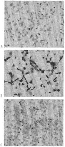 China human pancreatic carcinoma in-situ cell line