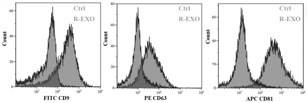 Homologous recombination exosome multi-drug delivery bionic nanoparticles as well as preparation method and application thereof