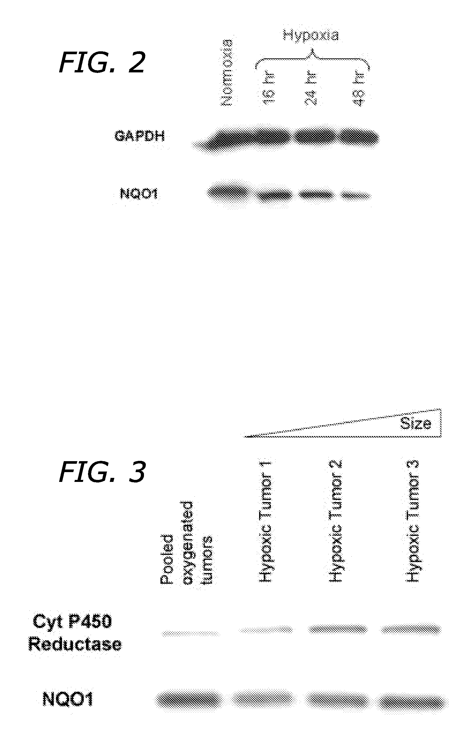 Indoloquinone Tumor Radiation Sensitization