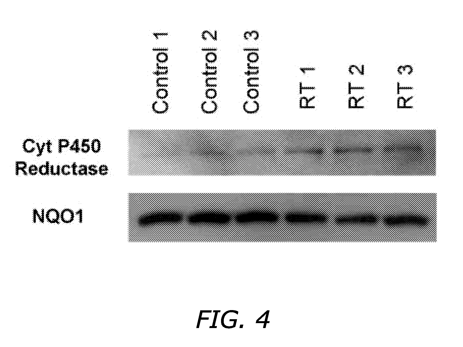 Indoloquinone Tumor Radiation Sensitization