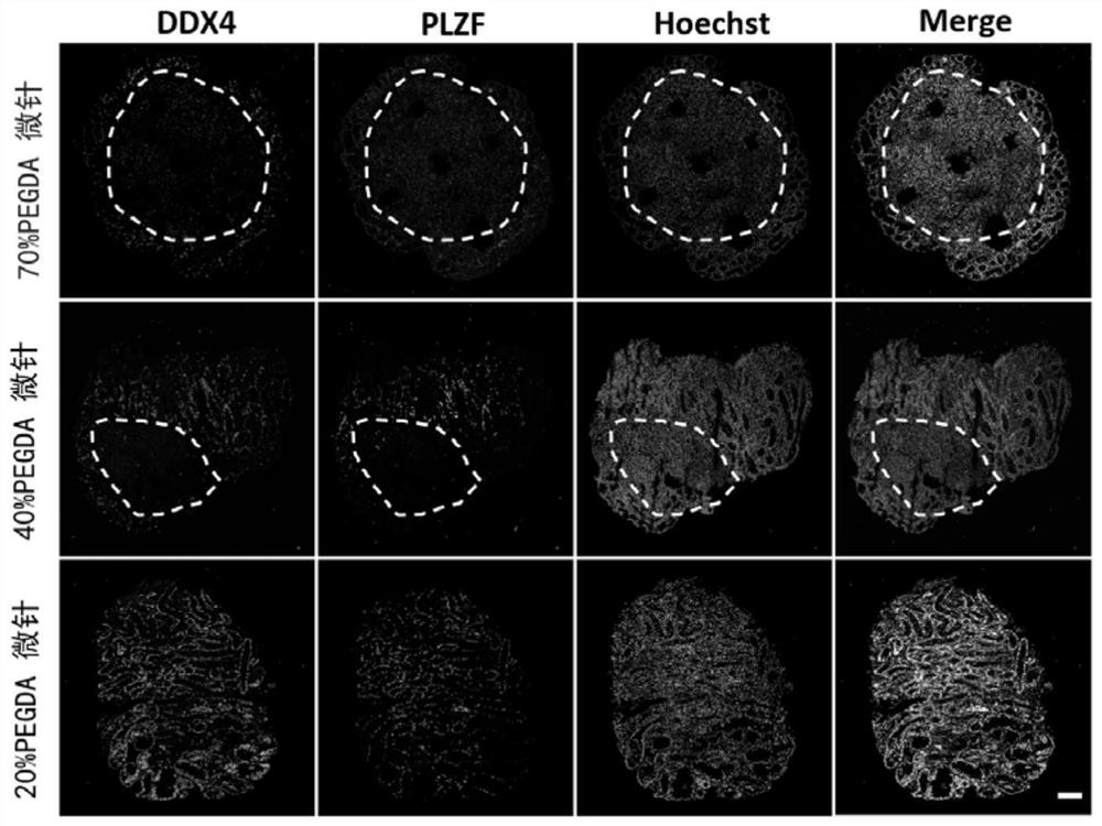 Micro-needle based in vitro culture method for testicular tissue and applications thereof